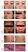 超皮秒公司_超皮秒儀器供應(yīng)商_超皮秒是亞皮秒嗎？