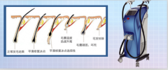 廣州脫毛儀器價(jià)格，脫毛一次多少錢，用什么儀器比較好？