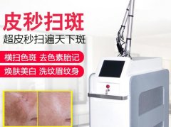 賽諾秀蜂窩皮秒機(jī)器多少錢一臺(tái)？755超皮秒機(jī)器設(shè)備價(jià)格報(bào)價(jià)